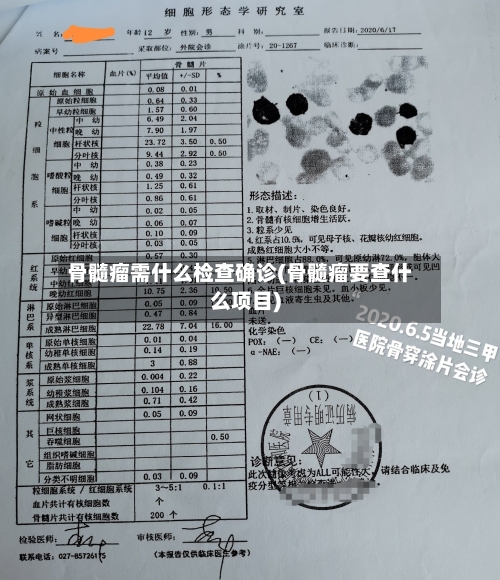 骨髓瘤需什么检查确诊(骨髓瘤要查什么项目)