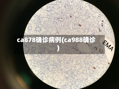 ca878确诊病例(ca988确诊)