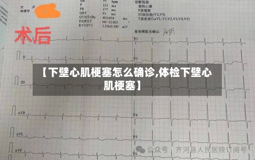 【下壁心肌梗塞怎么确诊,体检下壁心肌梗塞】