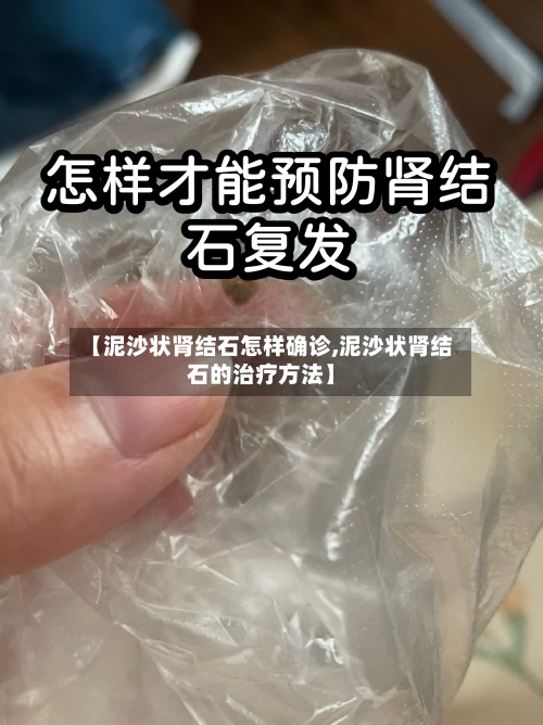 【泥沙状肾结石怎样确诊,泥沙状肾结石的治疗方法】-第3张图片