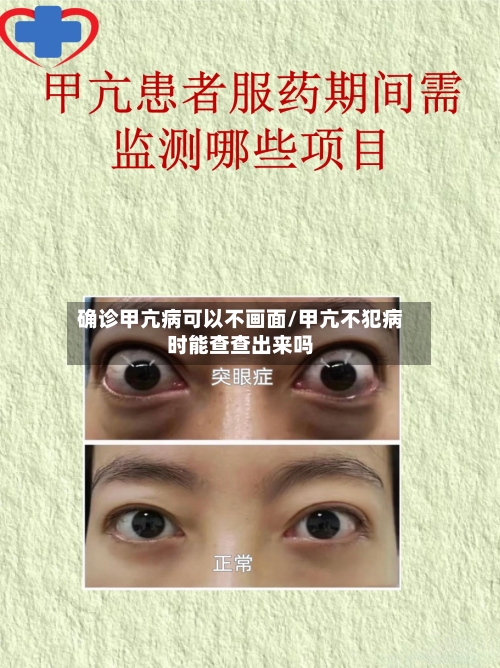 确诊甲亢病可以不画面/甲亢不犯病时能查查出来吗-第3张图片