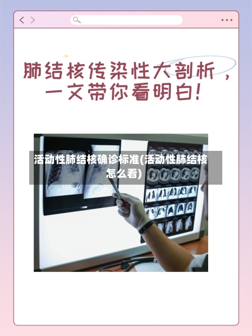 活动性肺结核确诊标准(活动性肺结核怎么看)-第2张图片
