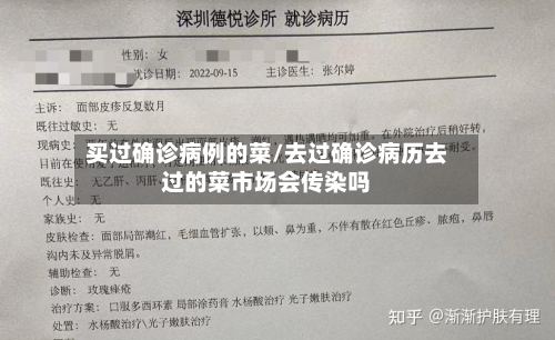 买过确诊病例的菜/去过确诊病历去过的菜市场会传染吗