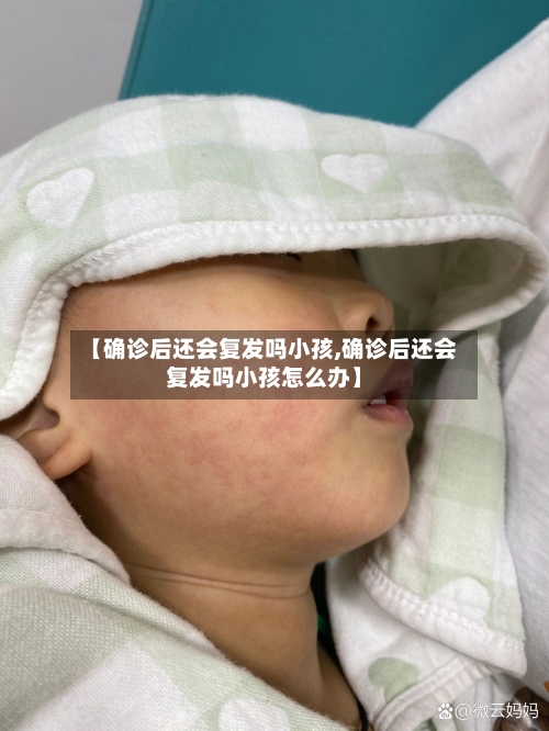 【确诊后还会复发吗小孩,确诊后还会复发吗小孩怎么办】-第2张图片