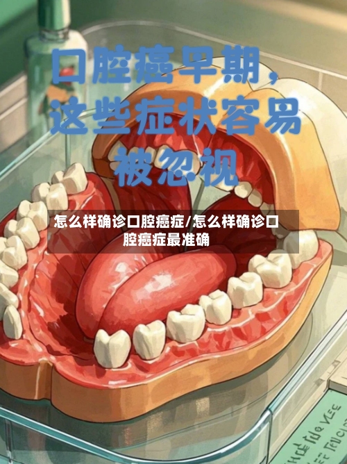 怎么样确诊口腔癌症/怎么样确诊口腔癌症最准确-第2张图片