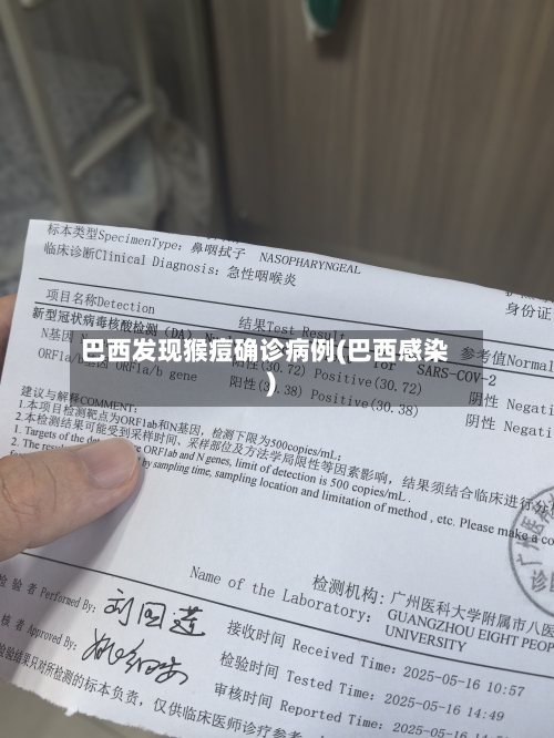 巴西发现猴痘确诊病例(巴西感染)-第3张图片