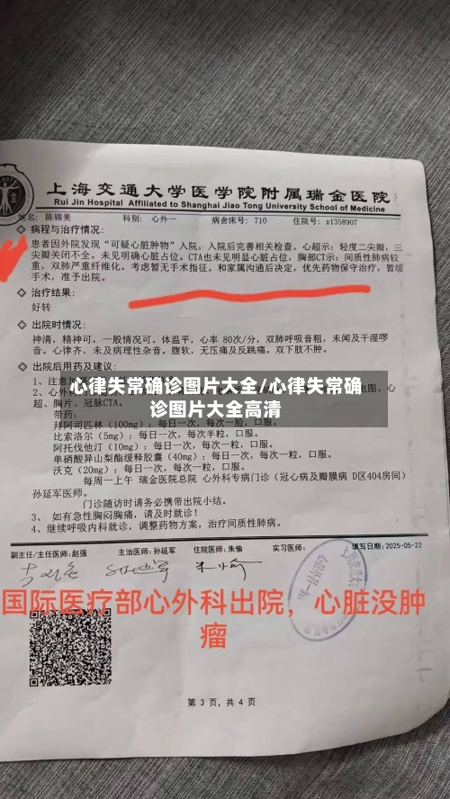 心律失常确诊图片大全/心律失常确诊图片大全高清