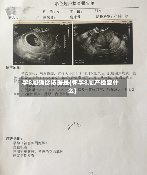 孕8周确诊依据是(怀孕8周产检查什么)-第2张图片