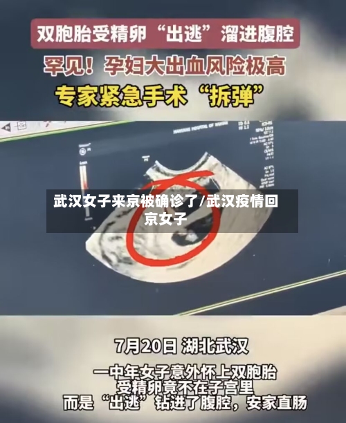 武汉女子来京被确诊了/武汉疫情回京女子