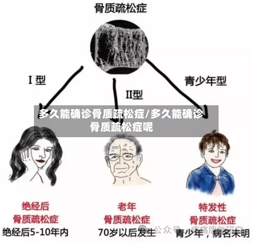 多久能确诊骨质疏松症/多久能确诊骨质疏松症呢