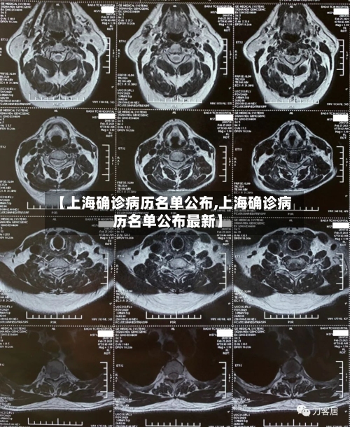 【上海确诊病历名单公布,上海确诊病历名单公布最新】