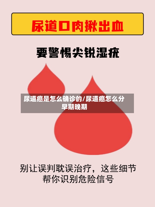 尿道癌是怎么确诊的/尿道癌怎么分早期晚期