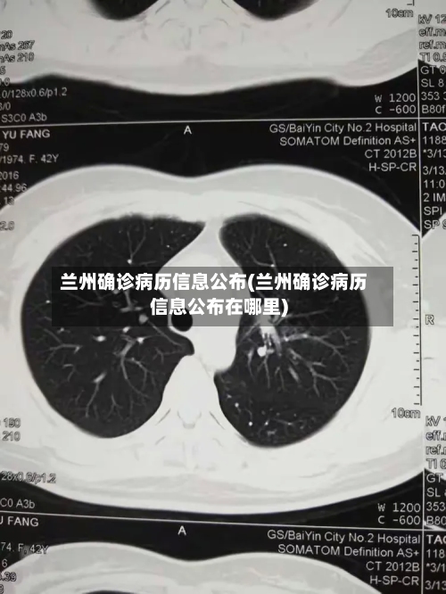 兰州确诊病历信息公布(兰州确诊病历信息公布在哪里)