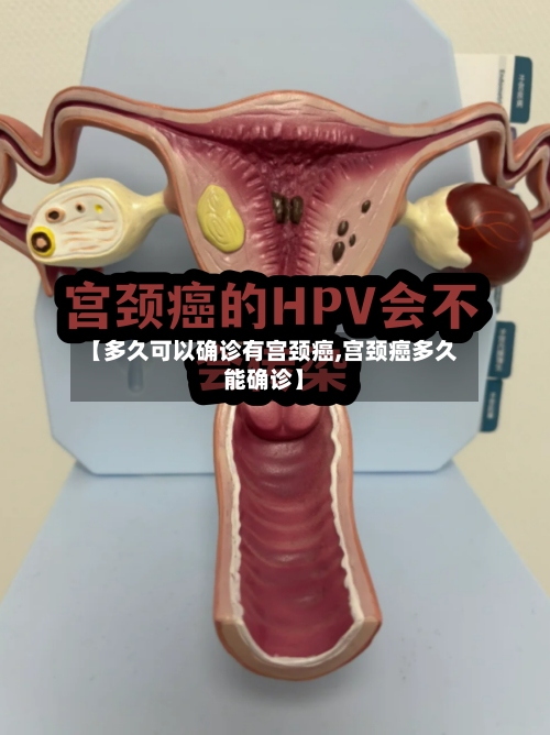 【多久可以确诊有宫颈癌,宫颈癌多久能确诊】-第2张图片