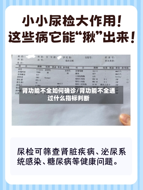 肾功能不全如何确诊/肾功能不全通过什么指标判断-第3张图片