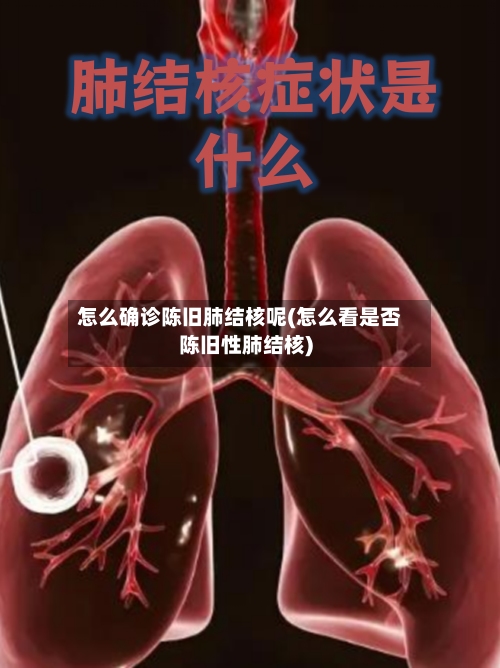 怎么确诊陈旧肺结核呢(怎么看是否陈旧性肺结核)