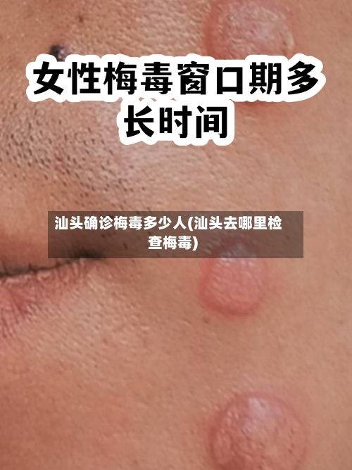 汕头确诊梅毒多少人(汕头去哪里检查梅毒)-第2张图片