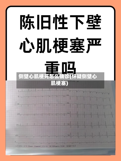 侧壁心肌梗死怎么确诊(怀疑侧壁心肌梗塞)