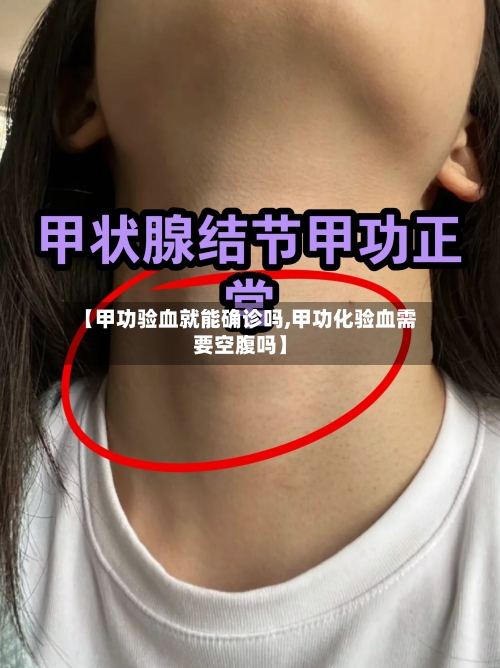 【甲功验血就能确诊吗,甲功化验血需要空腹吗】