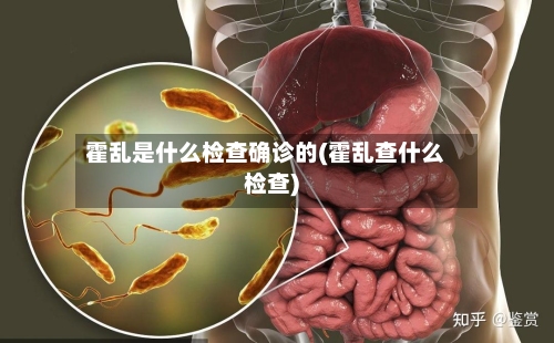 霍乱是什么检查确诊的(霍乱查什么检查)