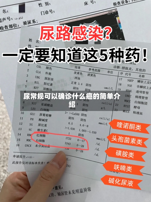 尿常规可以确诊什么癌的简单介绍-第2张图片