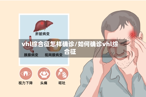 vhl综合征怎样确诊/如何确诊vhl综合征-第3张图片